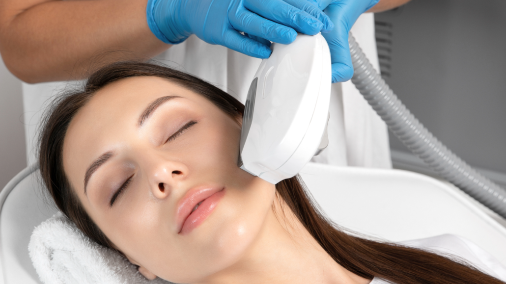 IPL photofacial treatment on the face at Le-Pelle med spa in Walnut Creek