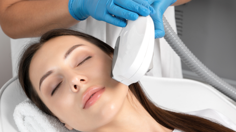 IPL photofacial treatment on the face at Le-Pelle med spa in Walnut Creek
