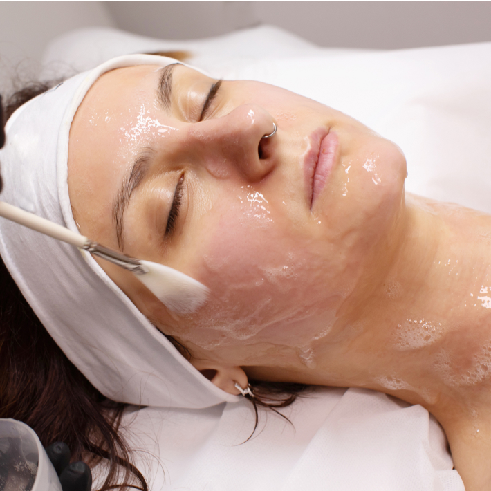 Facial skin treatment being performed at Le-Pelle med spa in Walnut Creek